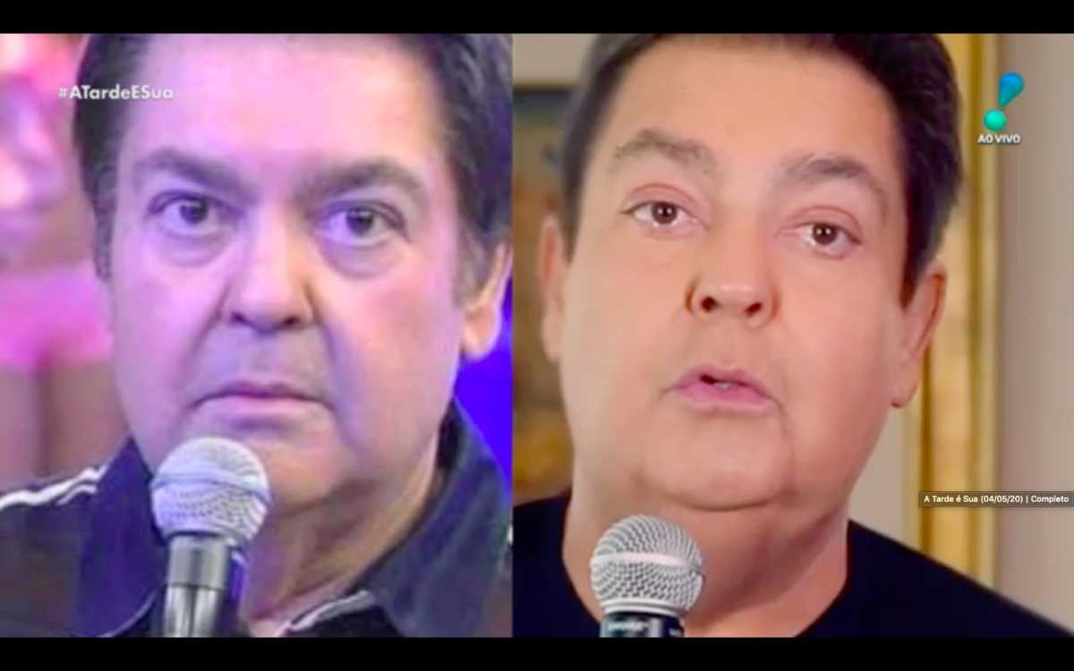 Faustão fez cirurgia plastica?