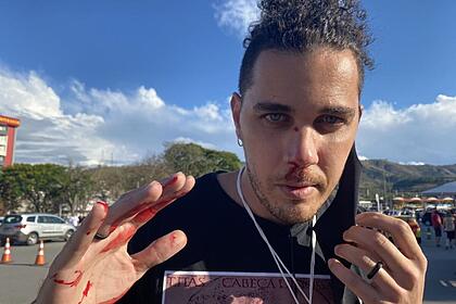 Leandro Matozo - cinegrafista da GloboNews - com as mãos ensanguentadas após ter sofrido a agressão