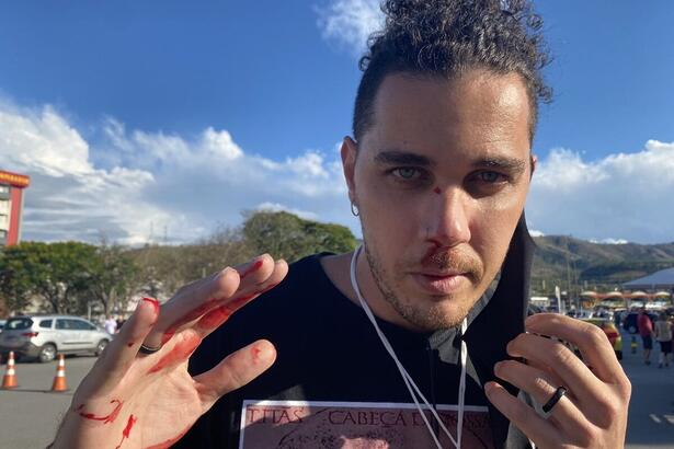 Leandro Matozo - cinegrafista da GloboNews - com as mãos ensanguentadas após ter sofrido a agressão