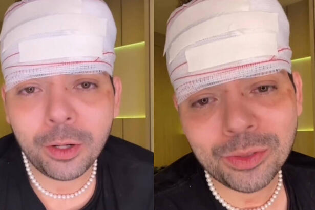 Gustavo Mendes em trechos do vídeo publicado no Instagram em que aparece com a cabeça enfaixada