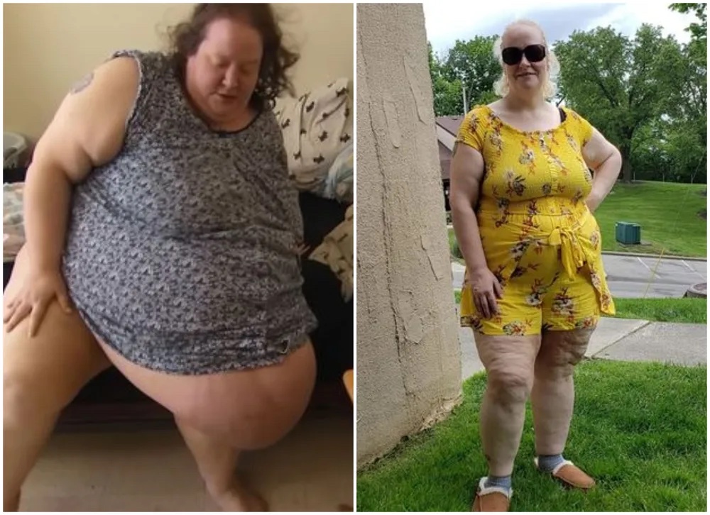 Antes e depois de Tamy