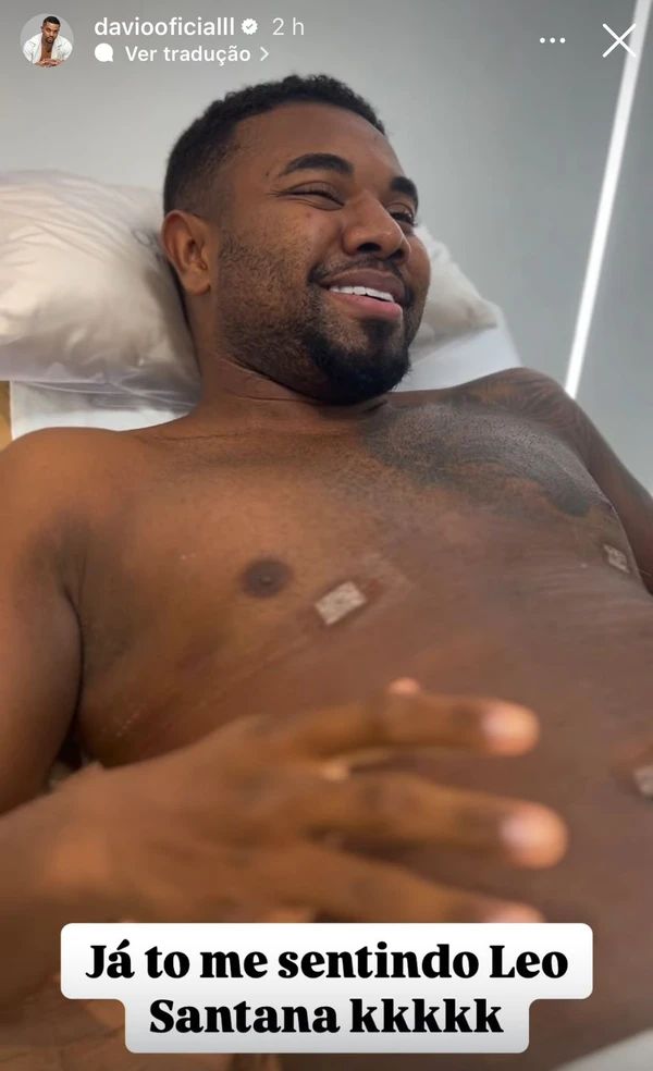 Davi Brito, sem camisa, mostrando o resultado da lipo HD nos stories do Instagram 