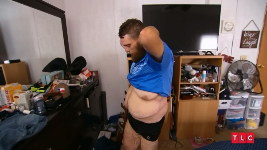 John se olha no espelho após participar do programa e sem camisa mostra o excesso de pele após a cirurgia bariátrica