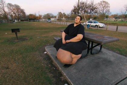 Paciente J.T. do programa "Quilos Mortais", sentado na lateral de um banco de cimento acoplado a uma mesa de piquenique. Ele usa uma camiseta e calças pretas. Sua perna esquerda exibe um grande inchaço causado por linfedema. Ao fundo, há um parque com árvores, grama e uma estrada