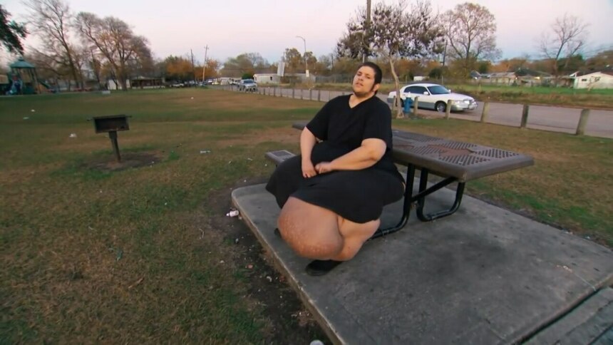 Paciente J.T. do programa "Quilos Mortais", sentado na lateral de um banco de cimento acoplado a uma mesa de piquenique. Ele usa uma camiseta e calças pretas. Sua perna esquerda exibe um grande inchaço causado por linfedema. Ao fundo, há um parque com árvores, grama e uma estrada