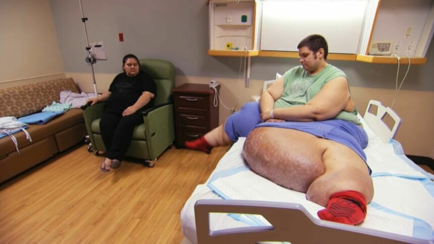 Um homem deitado em uma cama de hospital, com uma perna extremamente inchada, usa uma camisa verde e meias vermelhas. Uma mulher está sentada em uma poltrona próxima. O nome do arquivo o identifica como J.T., um paciente do programa 'Quilos Mortais'.