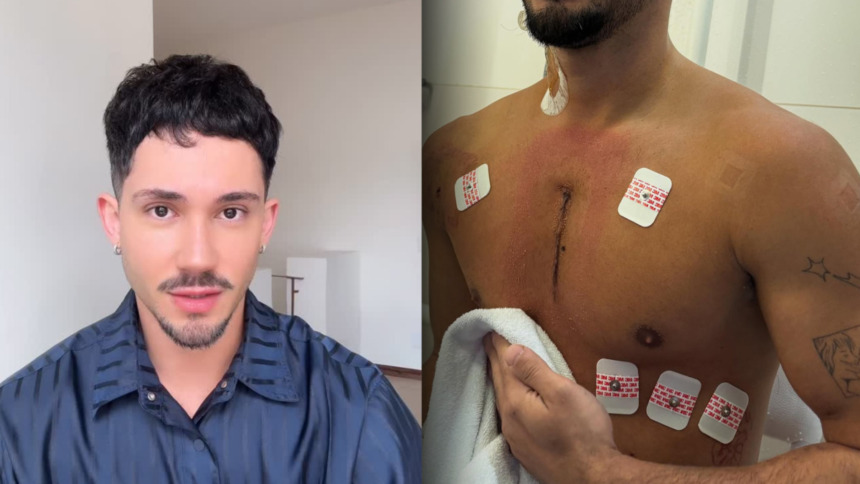 Vittor Fernando de camisa azul antes do ataque no Rio de Janeiro e depois, com uma cicatrix no peito após o atentado
