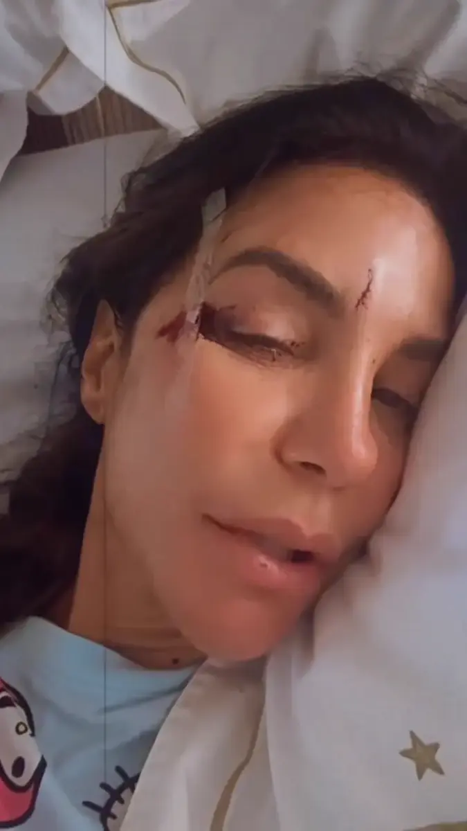 Ivete Sangalo deitada na maca do hospital