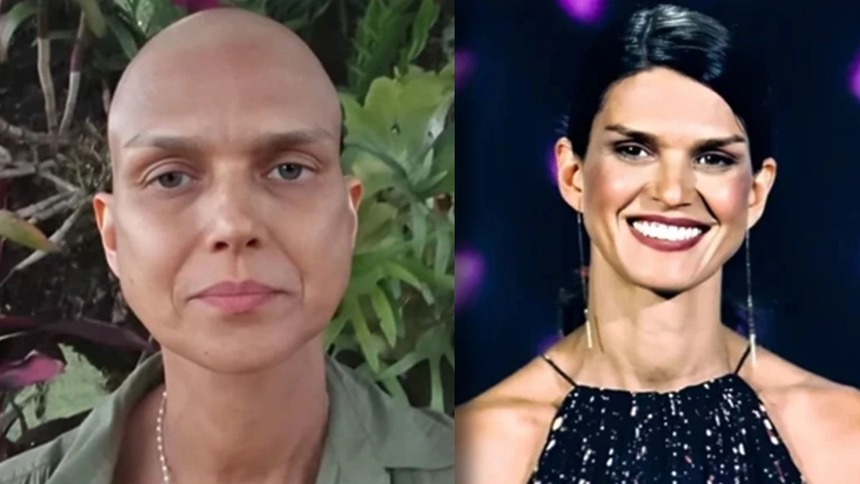 Karina Zeviani, careca e em trecho de sua apresentação no The Voice Brasil, em uma montagem
