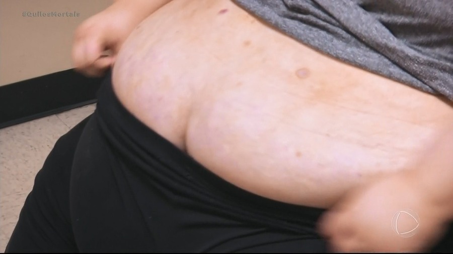 Close na grande barriga da participante