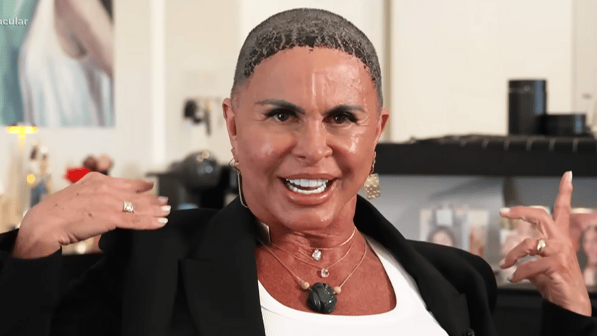 Gretchen sorridente, mas careca em entrevista ao Domingo Espetacular