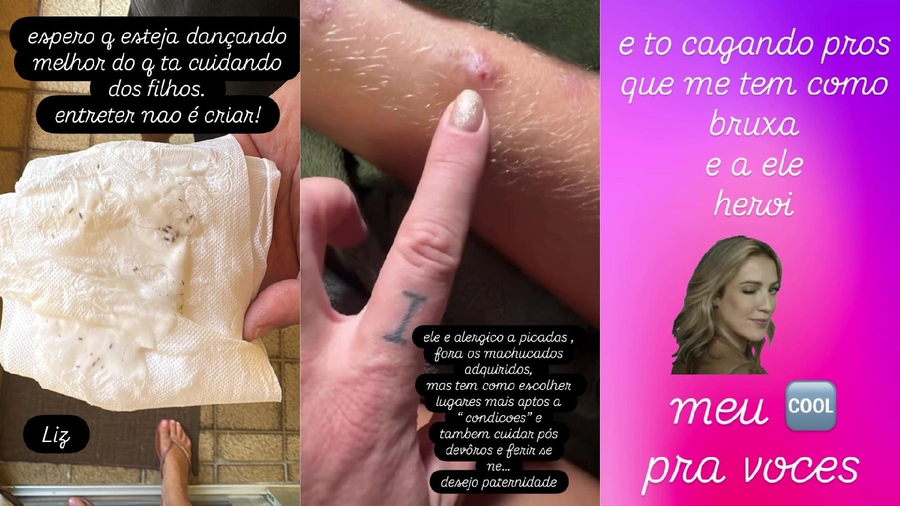 Luana Piovani Mostra Piolhos Na Cabeça Do Filho